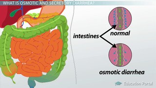 General Motility Disorders: Diarrhea and Constipation