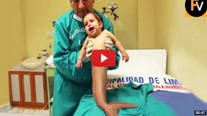 OMG !!! The case of mothers born half human fish