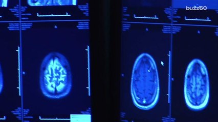 It's Your Brain's Fault You're A Bad Dancer