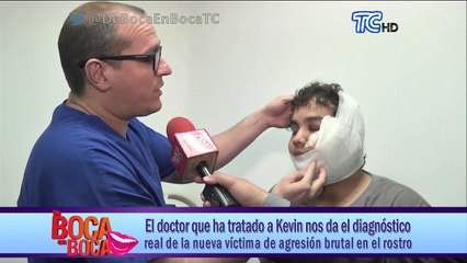 Doctor que ha tratado a Kevin nos da el diagnóstico real de la nueva víctima de agresión brutal en el rostro