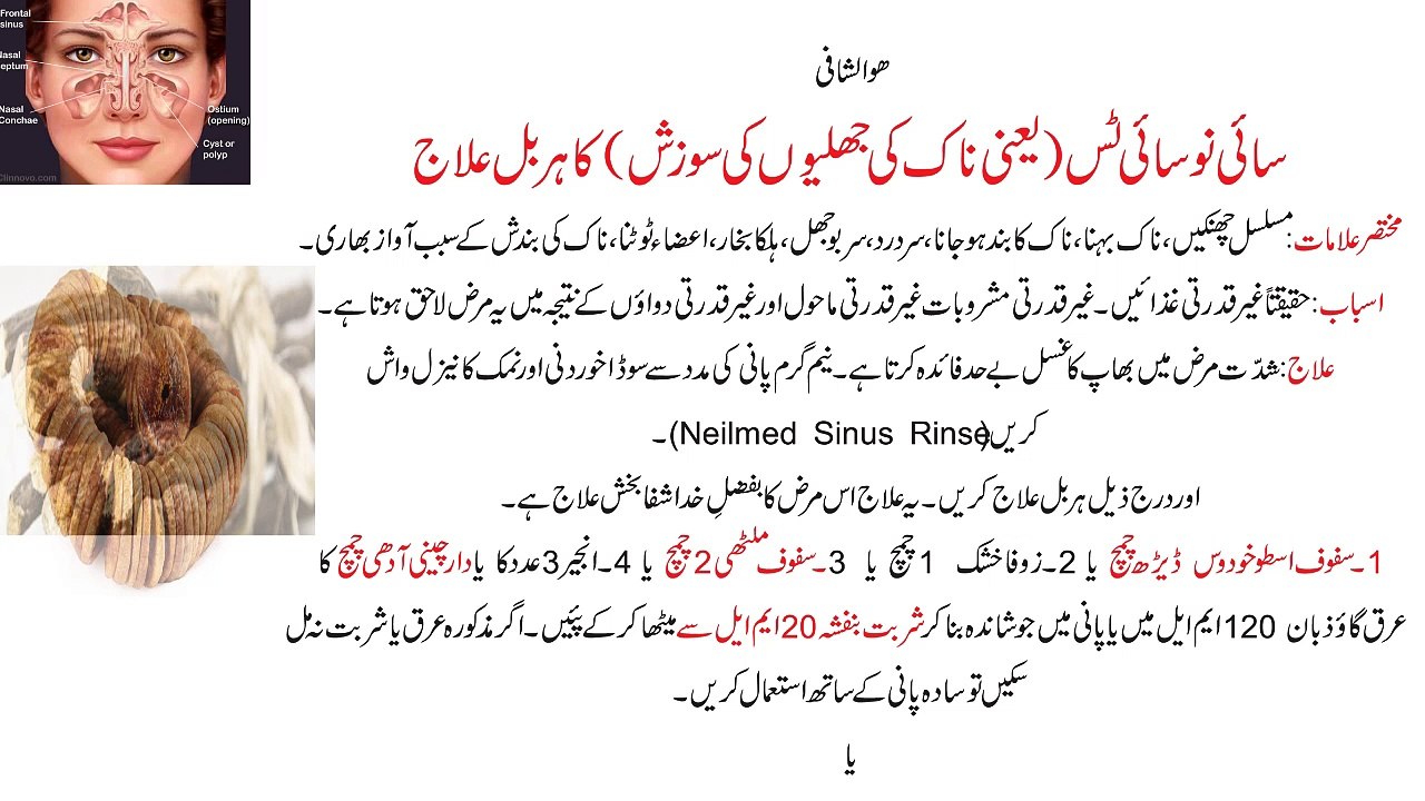 (سائی نو سائی ٹس کا ہربل علاج)Sinusitis Ka Herbal Ilaj