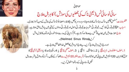 (سائی نو سائی ٹس کا ہربل علاج)Sinusitis Ka Herbal Ilaj