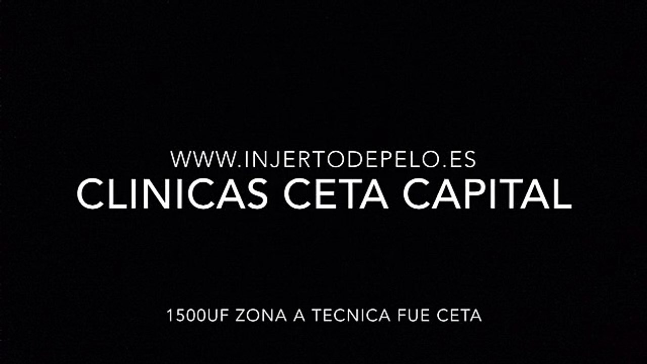 CLINICAS CETA CAPITAL www.injertodepelo.es
