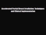 [PDF] Accelerated Partial Breast Irradiation: Techniques and Clinical Implementation Download