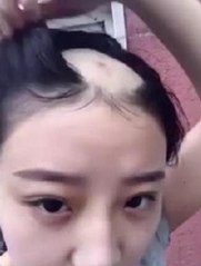 Saçını matkaba kaptıran kızdan ikinci video