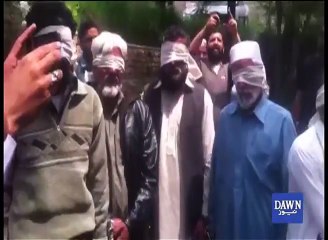 Girl set on fire as 'punishment' by Abbottabad jirga