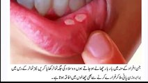 Tamatar Ke Fayde _ (Tomatoes) Tamatar Khane Ke Fawaid Benefits Of Tomato Urdu