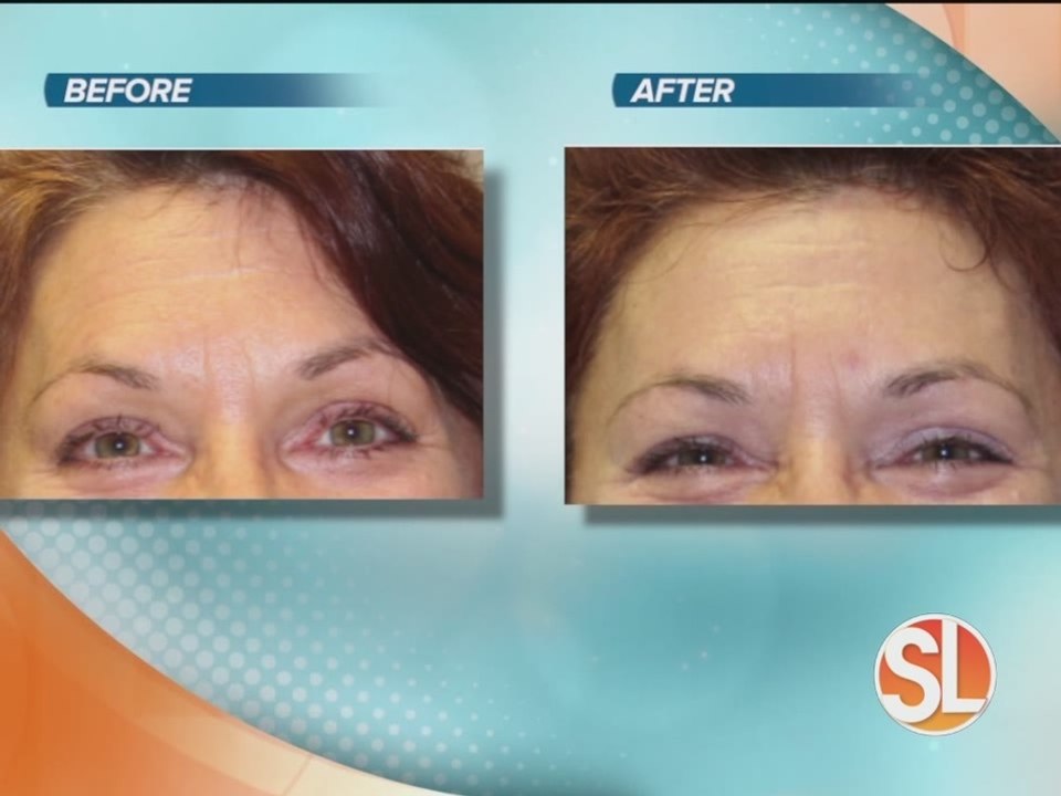 EAST Integrative Medicine offers facial rejuvenation or microneeling treatments