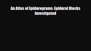 [PDF] An Atlas of Epidurograms: Epidural Blocks Investigated Download Full Ebook