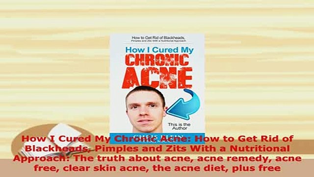 Download How I Cured My Chronic Acne How to Get Rid of Blackheads Pimples and Zits With a Read Online