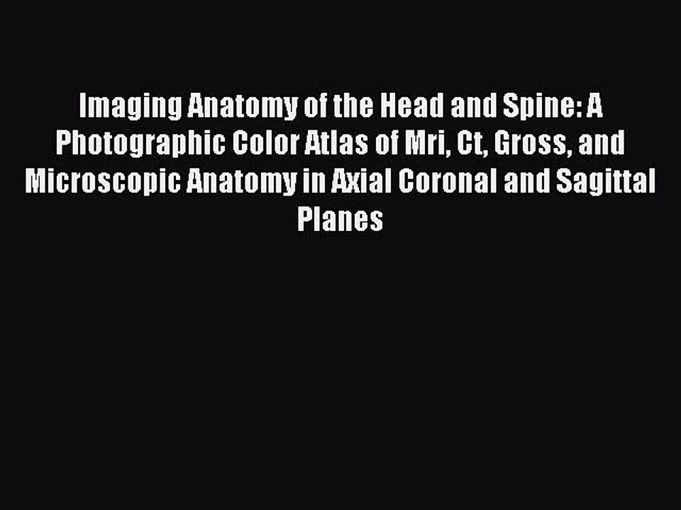 [Read PDF] Imaging Anatomy of the Head and Spine: A Photographic Color Atlas of Mri Ct Gross