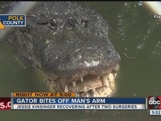 Man running from Lakeland police gets arm bitten off by gator