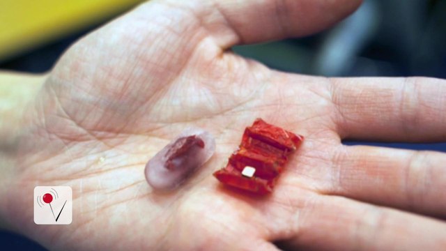 This Tiny Robot Could Save Your Child's Life