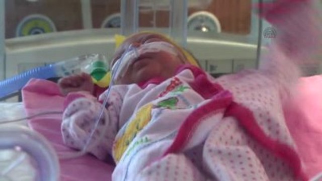 550 Gram Doğan Parmak Bebek Yaşama Tutundu