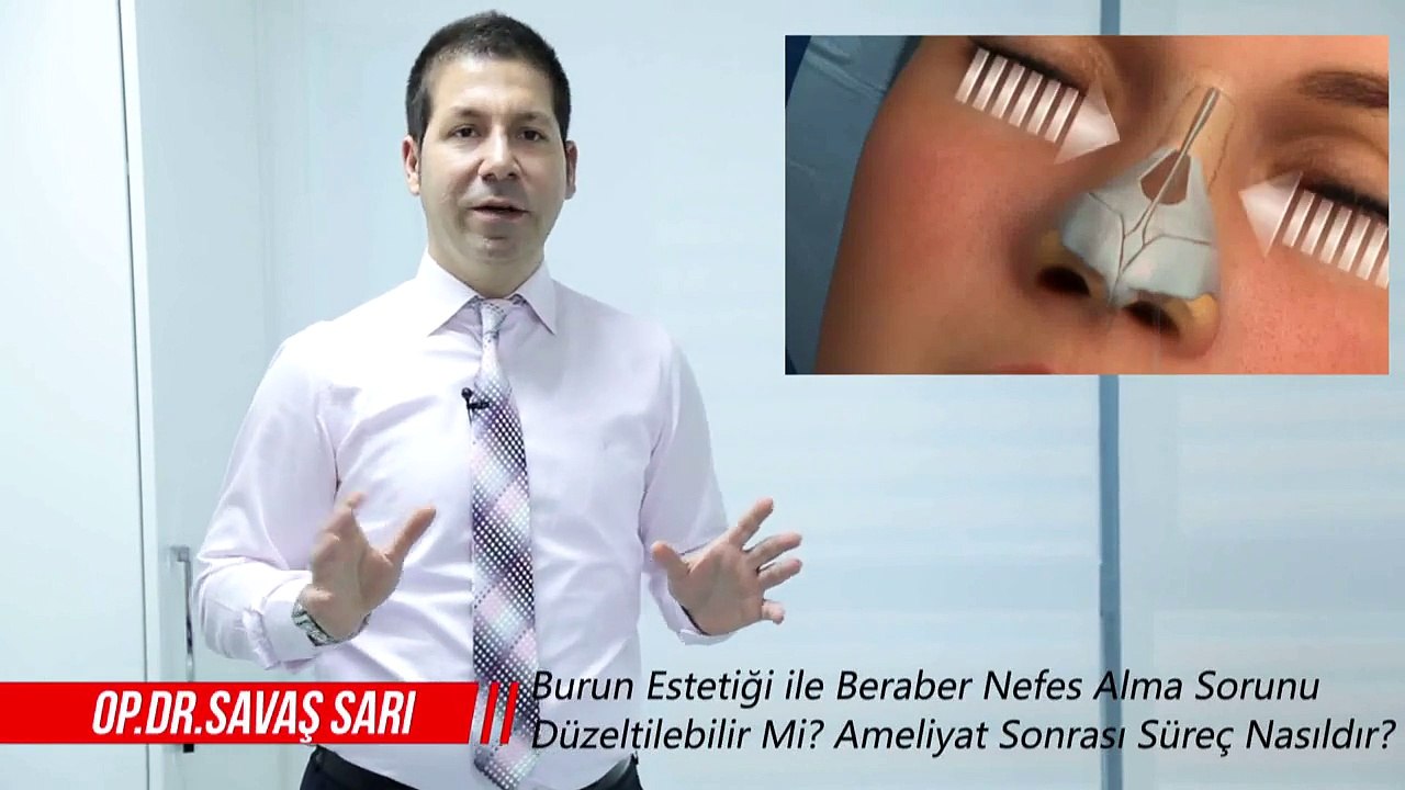 Opr. Dr. Savaş SARI Burun Estetiği Ameliyatı ve Sonrası