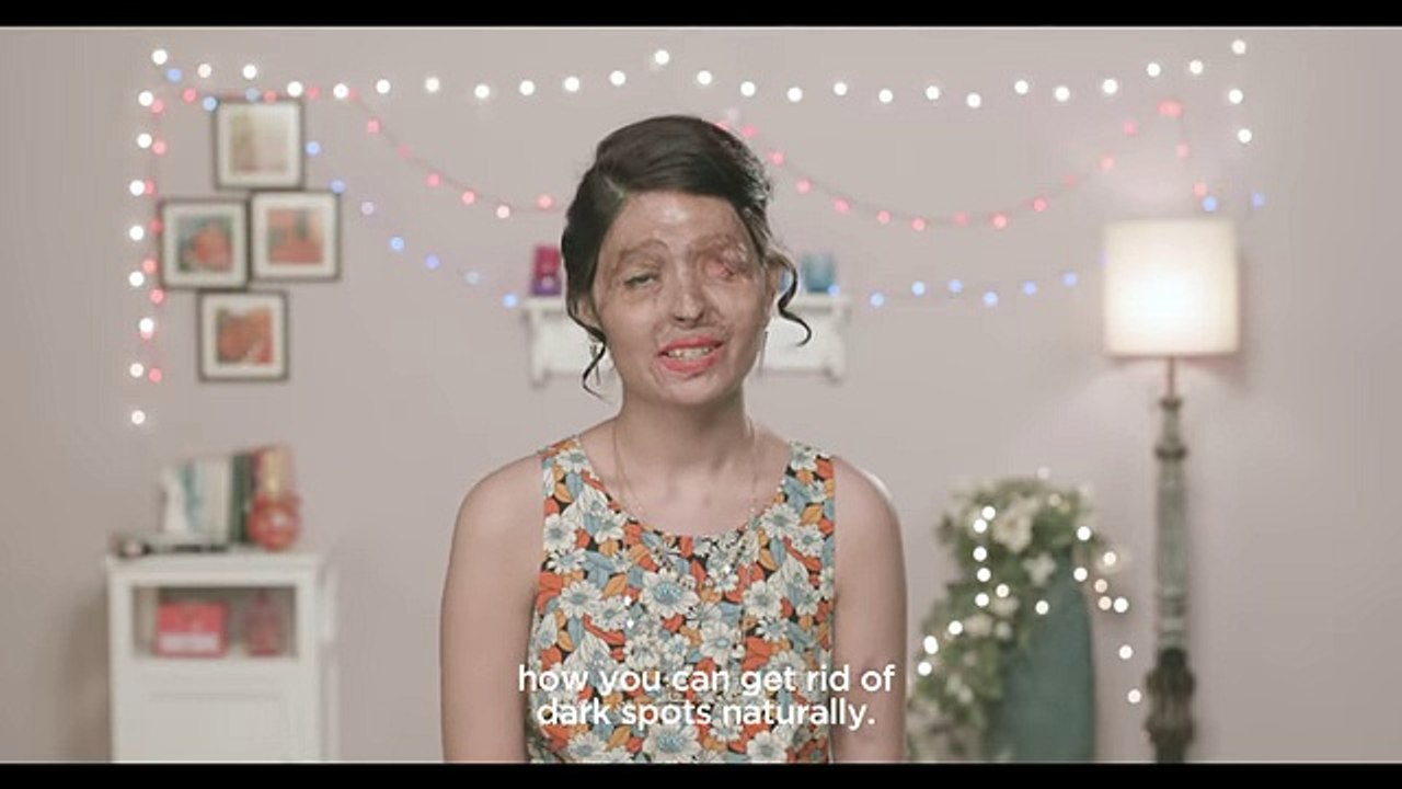 Beauty Tips by Reshma: How to get rid of dark spots naturally