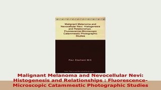 PDF  Malignant Melanoma and Nevocellular Nevi Histogenesis and Relationships  Read Full Ebook