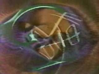 Antenne 2 - jingle Melancolies - 1978 [Majax ~ TeamTV]