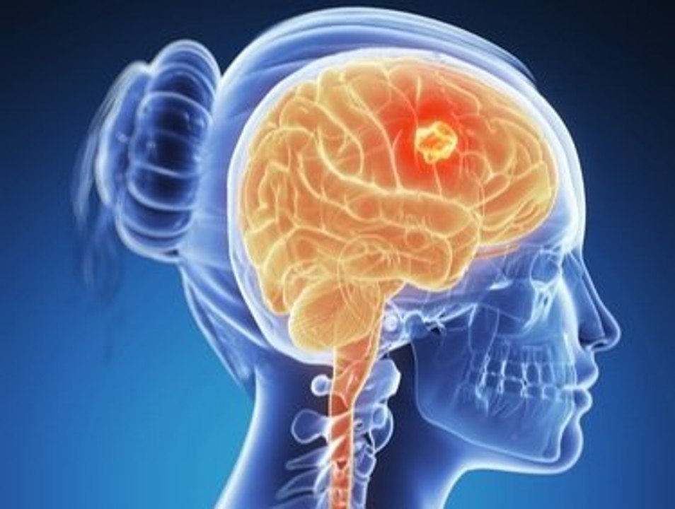 Antidiuretic hormone