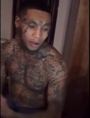 Dude Squeezes Bullet Out of His Leg