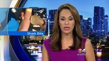 Un tiburón mordió el brazo de una mujer y no lo soltó hasta llegar al hospital