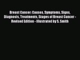 [PDF] Breast Cancer: Causes Symptoms Signs Diagnosis Treatments Stages of Breast Cancer - Revised