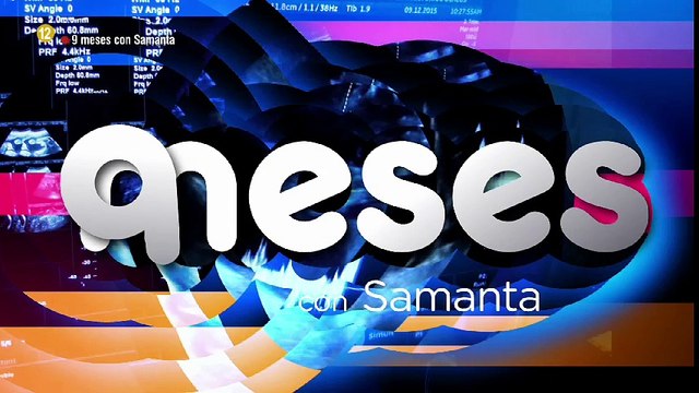 falacia pgm3 de 9 meses con Samanta