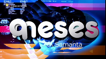 falacia pgm3 de 9 meses con Samanta