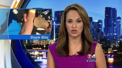 Tiburón Le Mordió El Brazo Y No Lo Soltó Hasta El Hospital