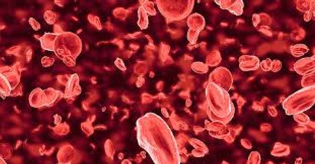 The different types of thalassemia and how they are treated