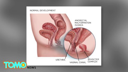 Woman gets pregnant even though her partner went in through the back door
