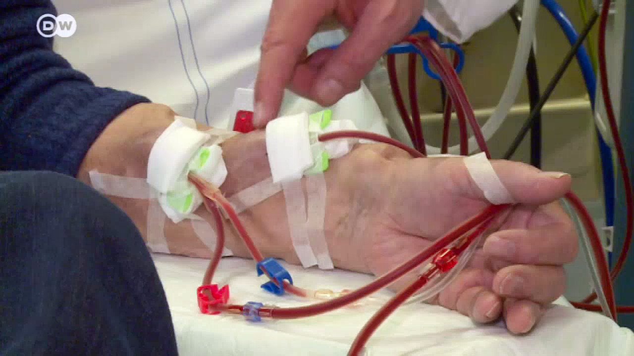 Woran man Nierenerkrankungen erkennt | Fit & gesund