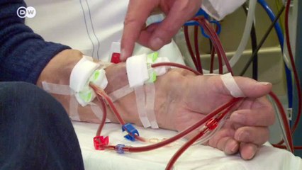 Woran man Nierenerkrankungen erkennt | Fit & gesund