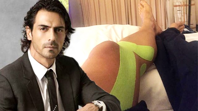 Arjun Rampal INJURED Leg On Kahaani 2 Sets
