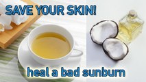 Dermatologist-Approved DIYs That Save Your Skin After a Sunburn