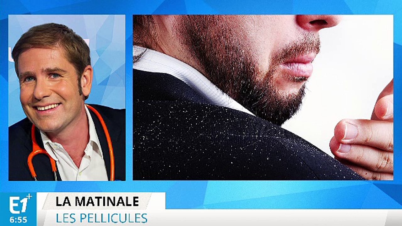 D'où viennent donc les pellicules ?