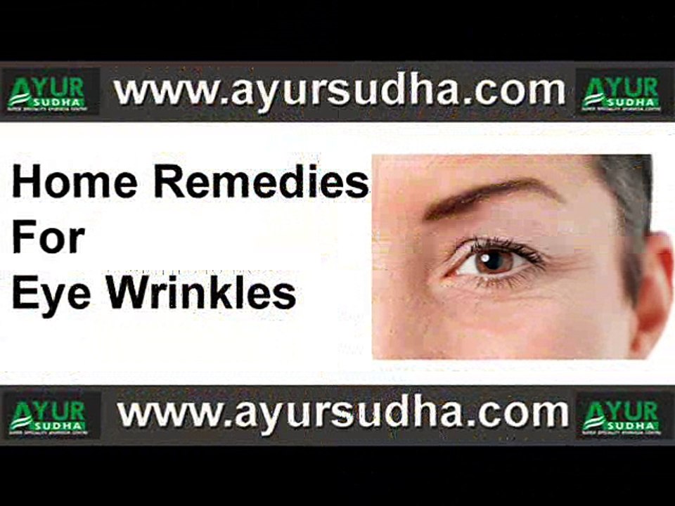 Home Remedies For Eye Wrinkles