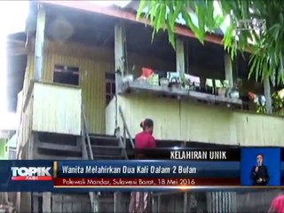 Ajaib, Dalam 2 Bulan Wanita Ini Melahirkan Dua Kali