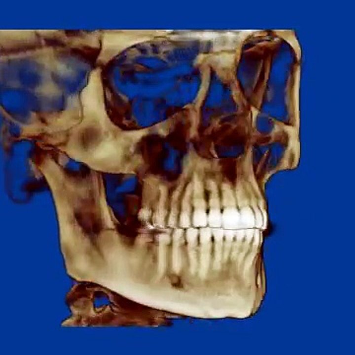 3D Imaging i-CAT