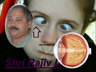 Tips For Eye Problem Rajiv Dixit