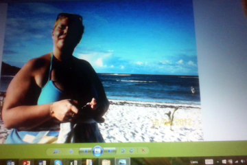 Journée de l'Obésité ... moi j'ai été sleevée en Guadeloupe ! - LTOM