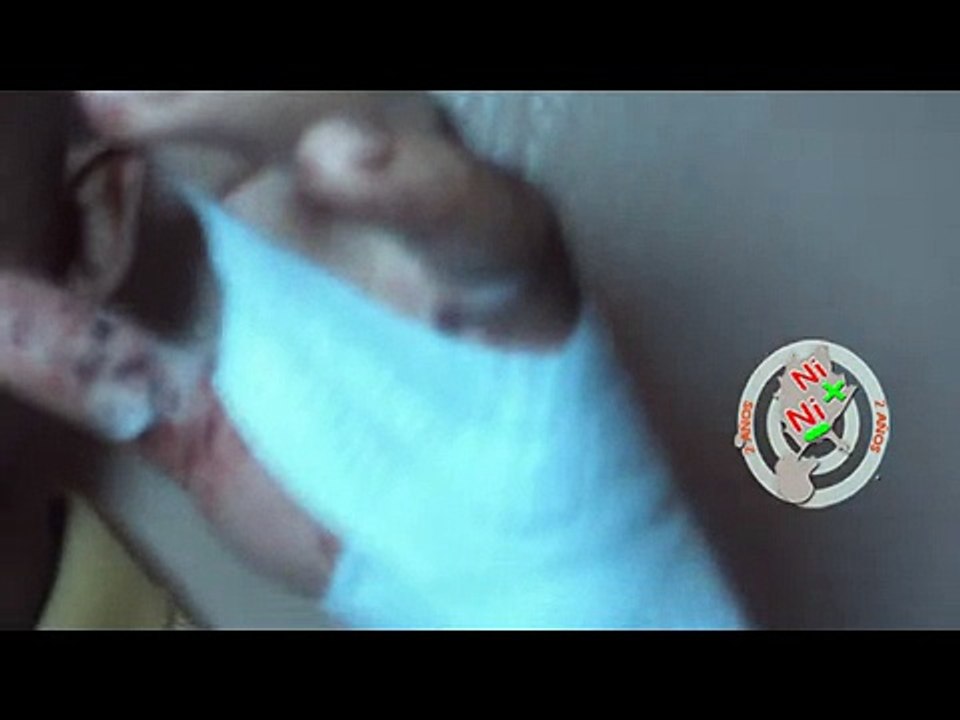 EL PINTO RECIBE 17 MACHETAZO