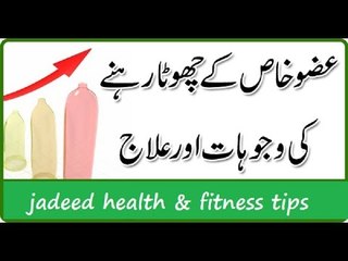 Khatna Kiun Zaruri he - Uzwe khas ka khatna kab karna chahye in urdu hindi 2016