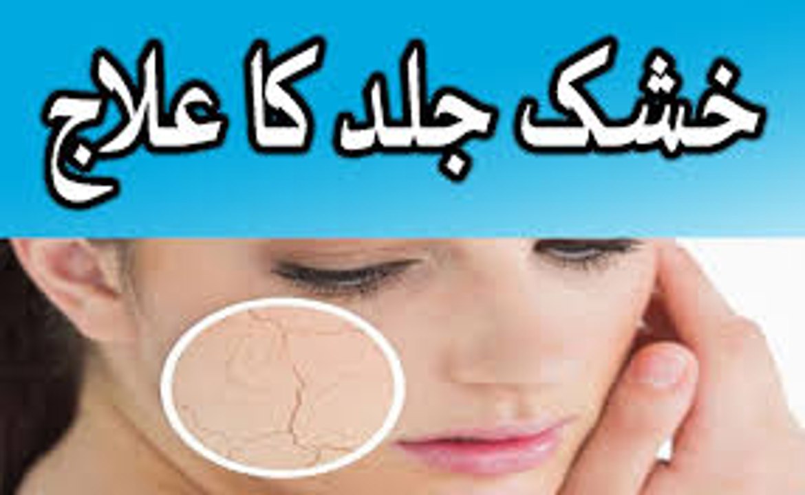 khushk jild ka ilaj - khushk jild ka desi nuskha aur ilaj in urdu hindi