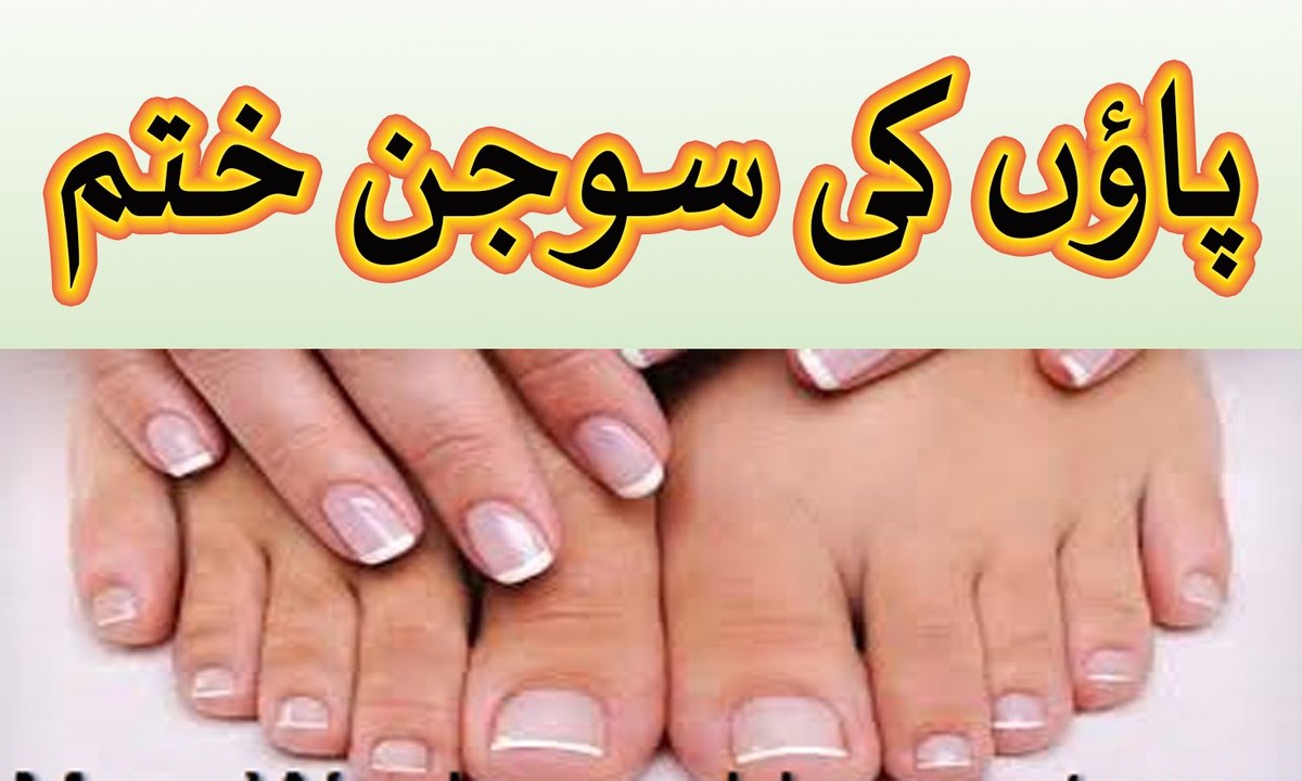 paon ki sujan ka ilaj - paon ki sozish ka khatam karne ka tarika in urdu hindi