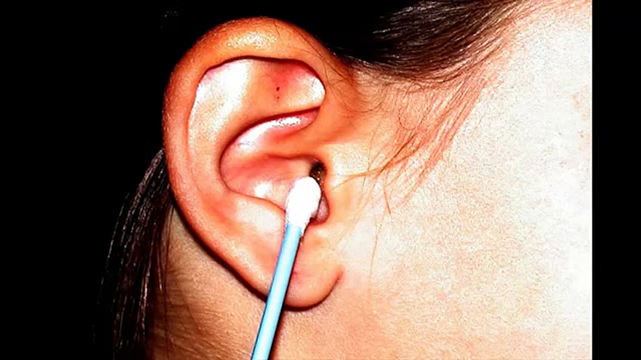 Porque no debes limpiarte los oidos con copitos de algodón.
