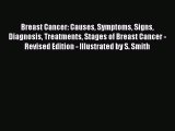 Read Breast Cancer: Causes Symptoms Signs Diagnosis Treatments Stages of Breast Cancer - Revised