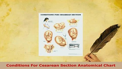 Download  Conditions For Cesarean Section Anatomical Chart Free Books