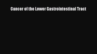 Read Cancer of the Lower Gastrointestinal Tract Ebook Free