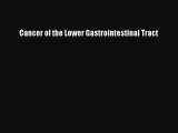 Read Cancer of the Lower Gastrointestinal Tract Ebook Free